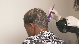 Curing and Preventing Premature Greying in Young Men