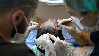 Hair Transplant Turkey: Why MedArt Hair Stands Above the Rest