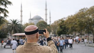 Hair Transplant in Turkey: Read This First 