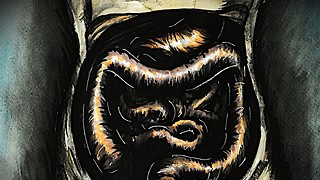 Are parasitic worms what's missing in our immune systems?