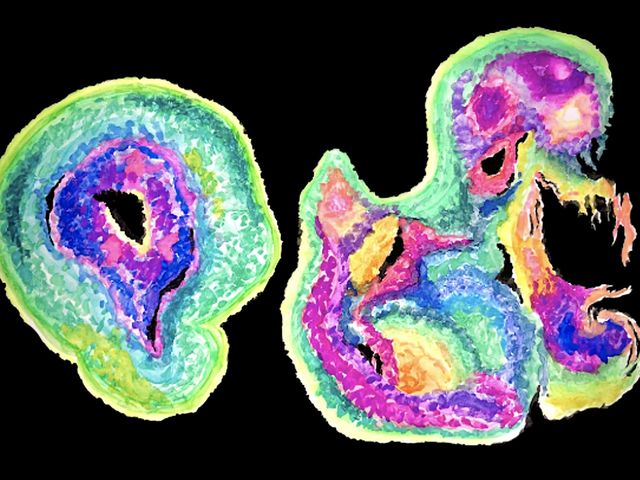 Cerebral organoids: Fact and fiction