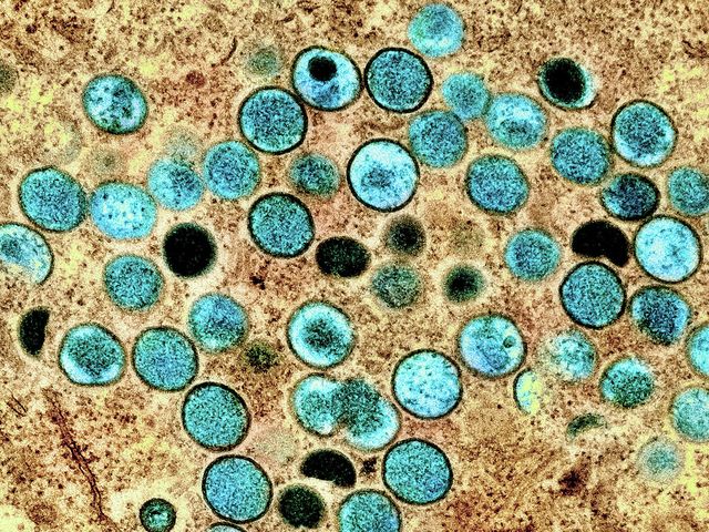 Does the mpox outbreak spell disaster for global health?
