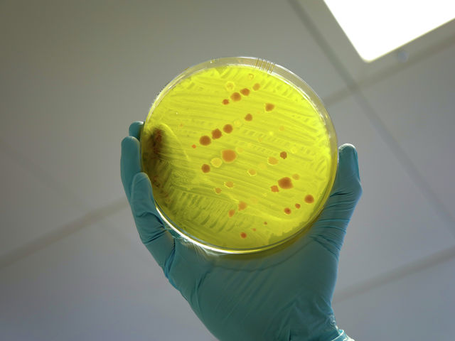 The battle against antimicrobial resistance