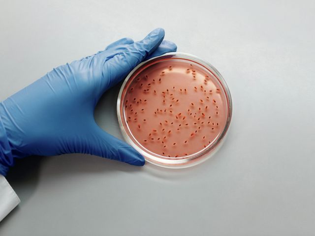 Bacteria on the mind?