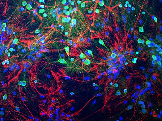 Can ‘cloaked cells’ help us cure Alzheimer's?